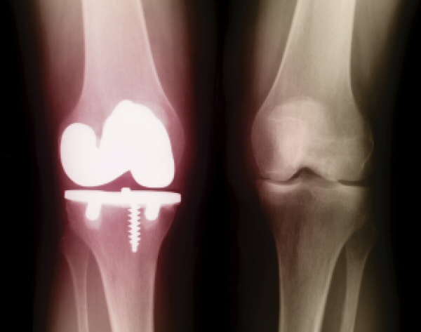 TI | Medical | Specialty Metals | Medical Grade